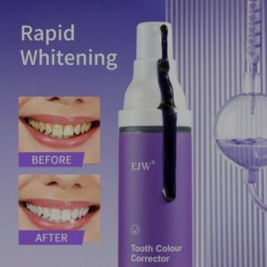 Teeth whitening